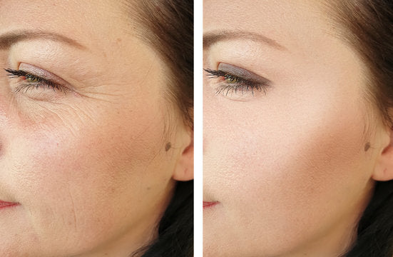 Integratore Antiage con Collagene Idrolizzato e Vitamina C