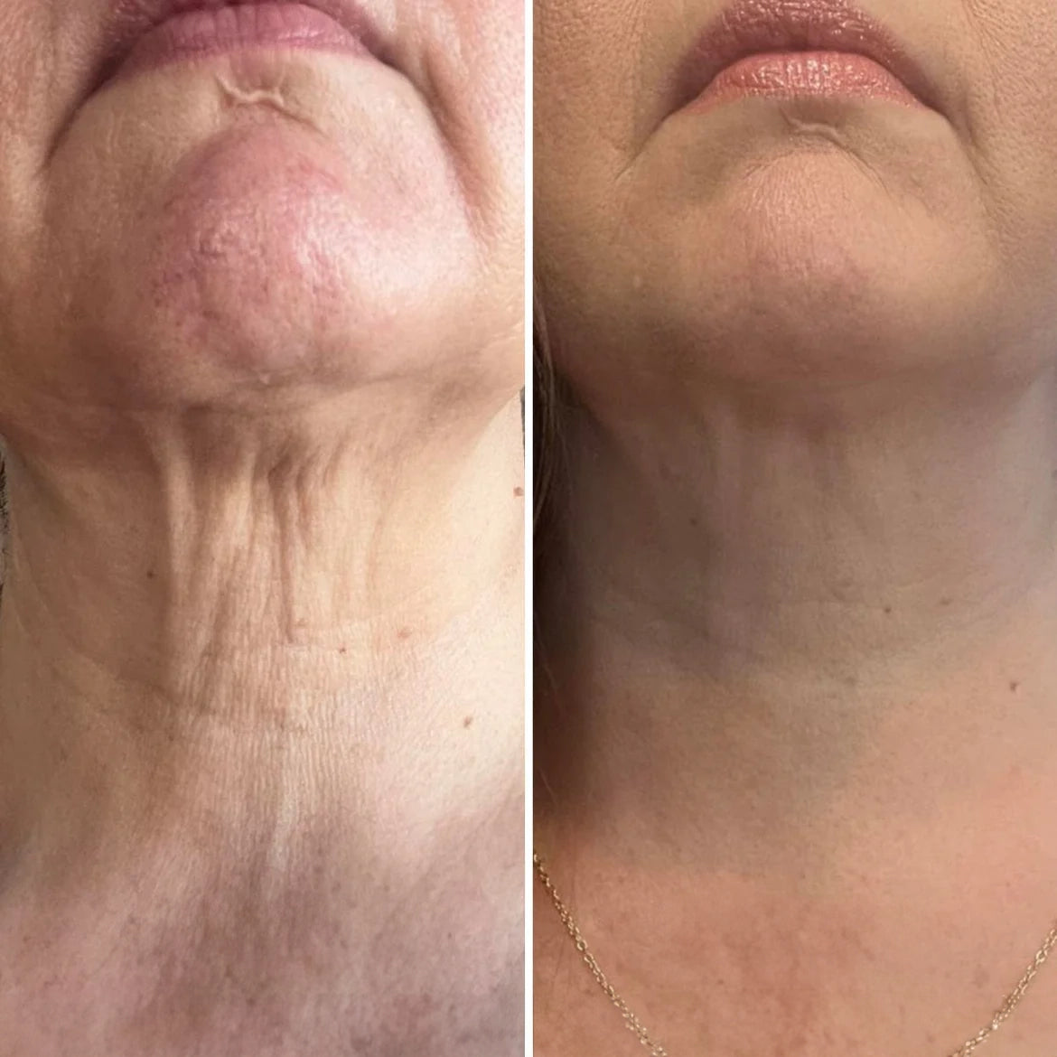 Integratore Antiage con Collagene Idrolizzato e Vitamina C