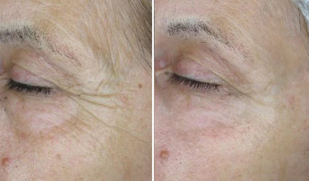 Integratore Antiage con Collagene Idrolizzato e Vitamina C