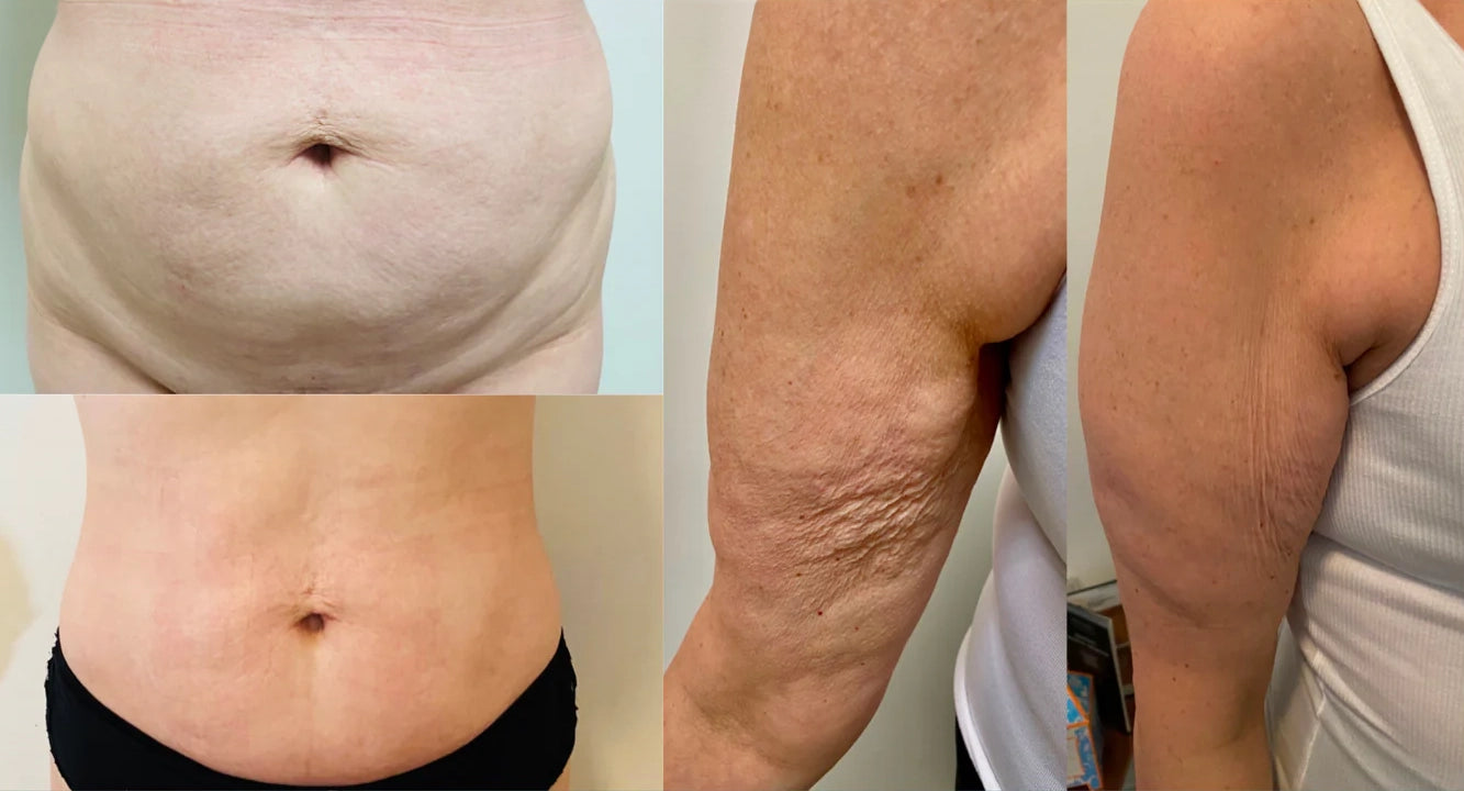 Integratore Antiage con Collagene Idrolizzato e Vitamina C