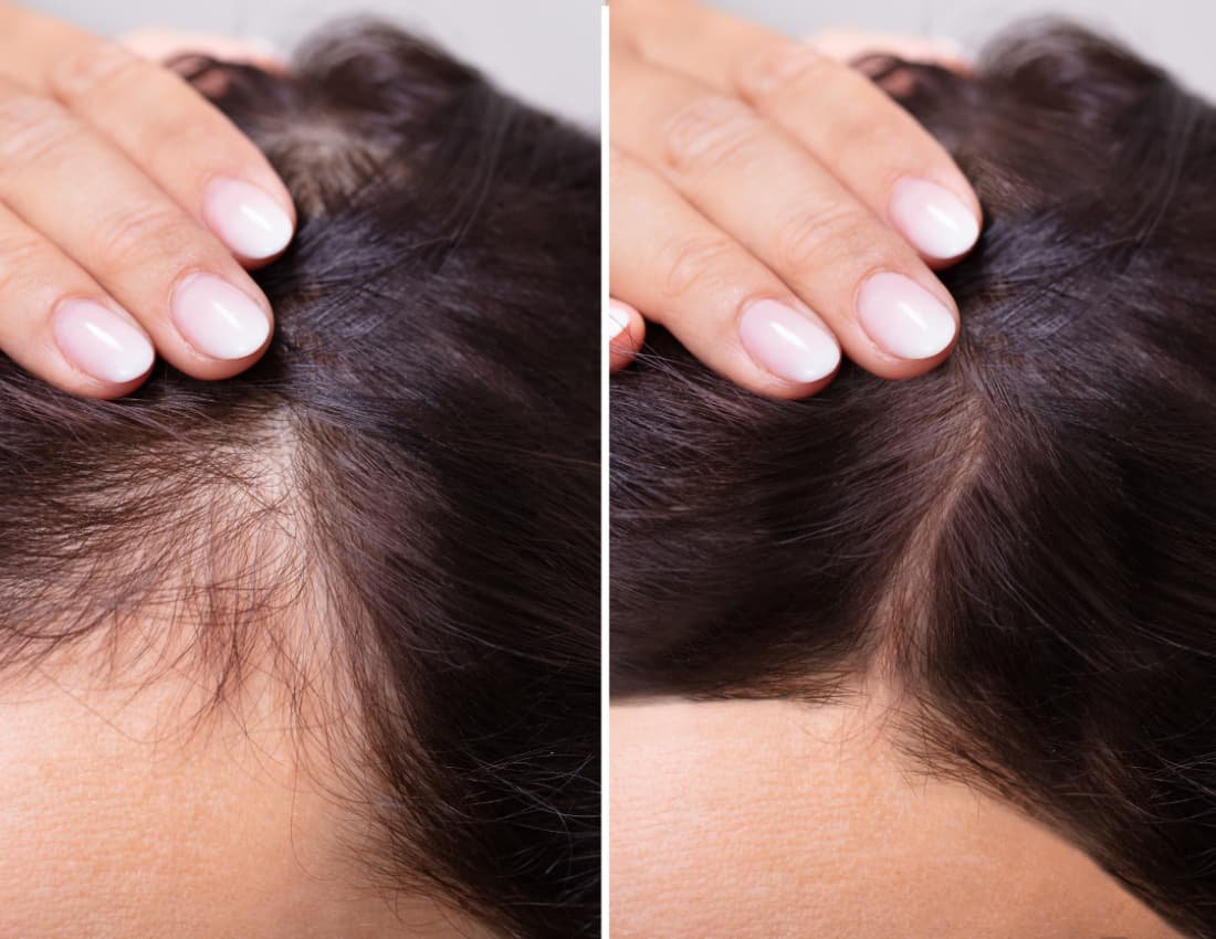 Integratore Antiage con Collagene Idrolizzato e Vitamina C