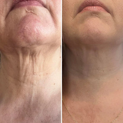 Integratore Antiage con Collagene Idrolizzato e Vitamina C