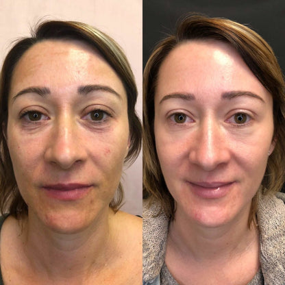 Integratore Antiage con Collagene Idrolizzato e Vitamina C