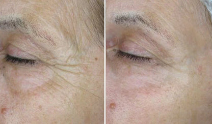 Integratore Antiage con Collagene Idrolizzato e Vitamina C