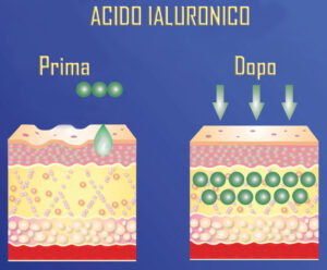 L'effetto dell'acido ialuronico prima e dopo la sua applicazione sulla pelle.